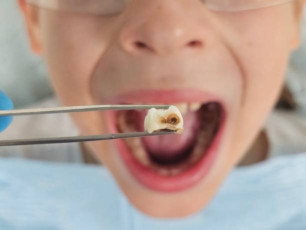 Best Emergency Denture Repair in Versailles, MO